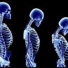 Poor posture changes our stability